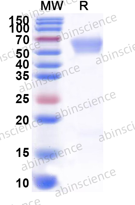 ANDV Gc Recombinant Protein (C-His)