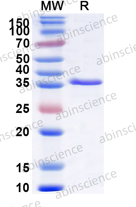 ANDV Nucleoprotein Recombinant Protein (N-His)