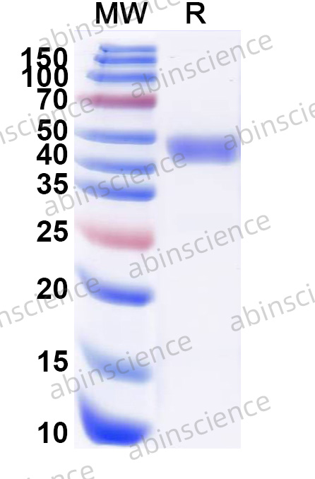 ANDV Gn Recombinant Protein (C-His)
