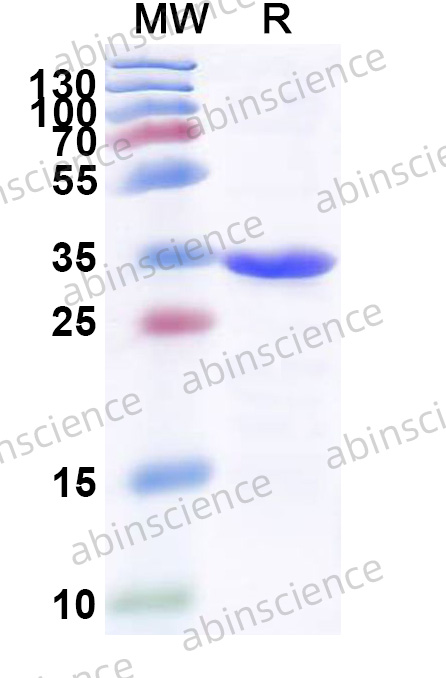SEOV Nucleoprotein Recombinant Protein (N-His)