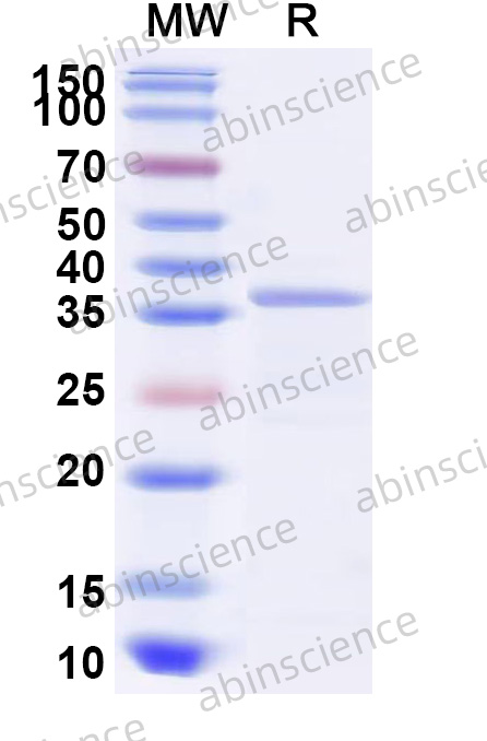 VZV/HHV-3 gB/Envelope glycoprotein B/UL27 Recombinant Protein (N-His)