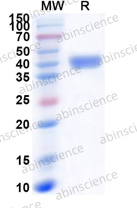 HSV1/HHV-1 glycoprotein D/gD Recombinant Protein (N-GST&C-His)