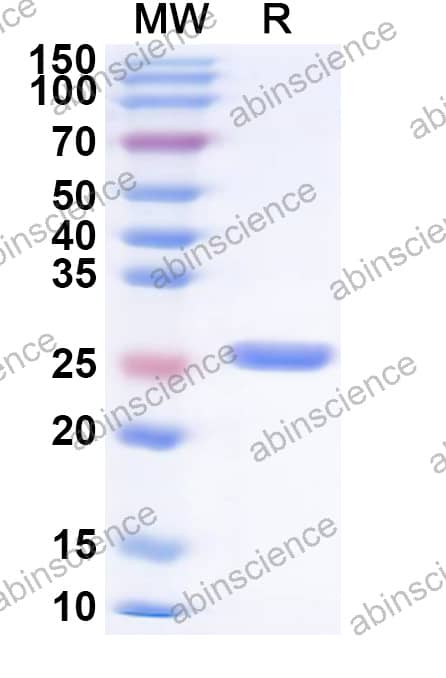VSV Matrix Recombinant Protein (N-His)