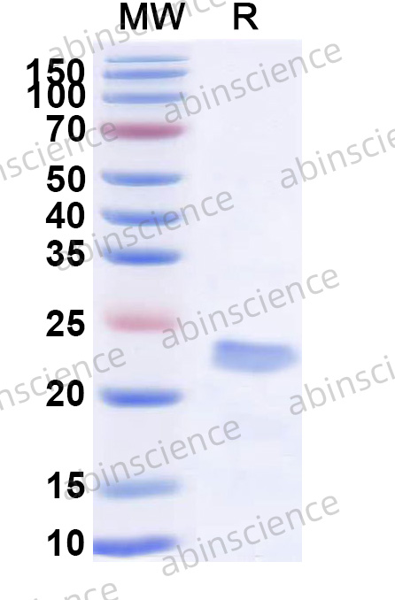 Recombinant VSIV RdRp/Protein L, C-His
