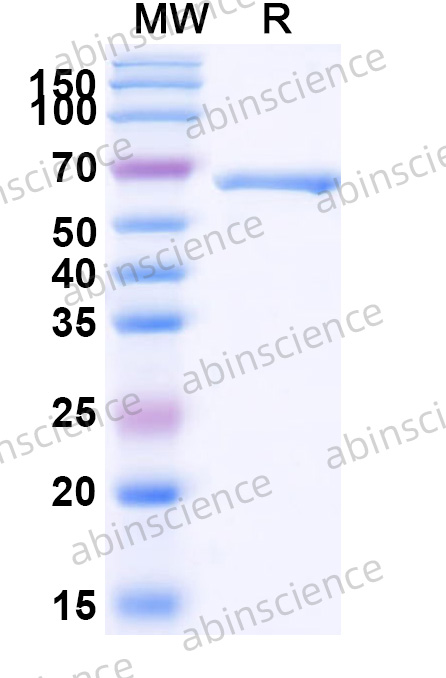 VSV Nucleoprotein Recombinant Protein (N-His-SUMO)