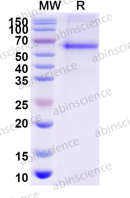 VSV Glycoprotein G Recombinant Protein (C-His)