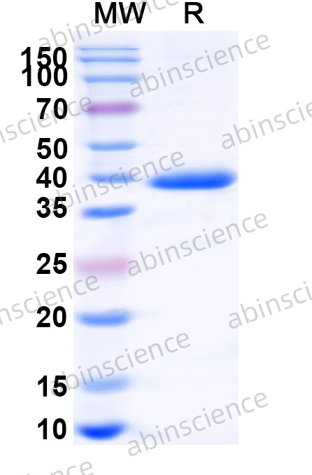 Recombinant HPV52 E7 Protein, N-GST & C-His