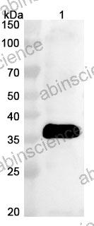 Anti-HPV58 E7 Polyclonal Antibody