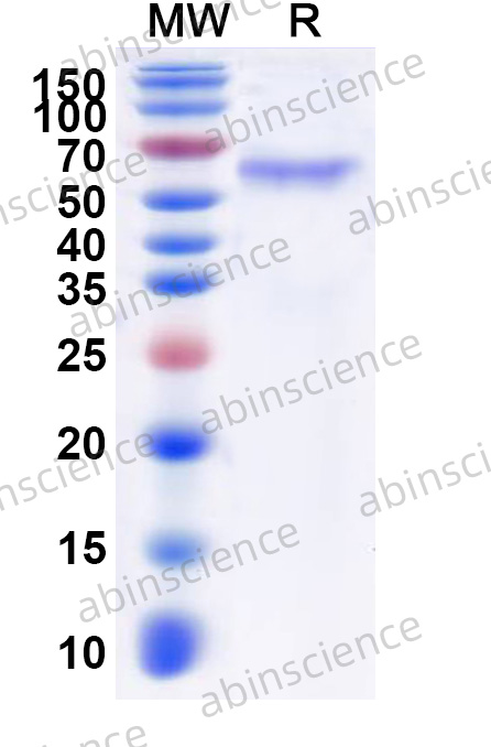 CHIKV Spike Glycoprotein E1 Recombinant Protein (C-His)