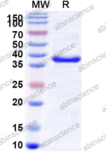 RRV Spike glycoprotein E2 Recombinant Protein (N-His)