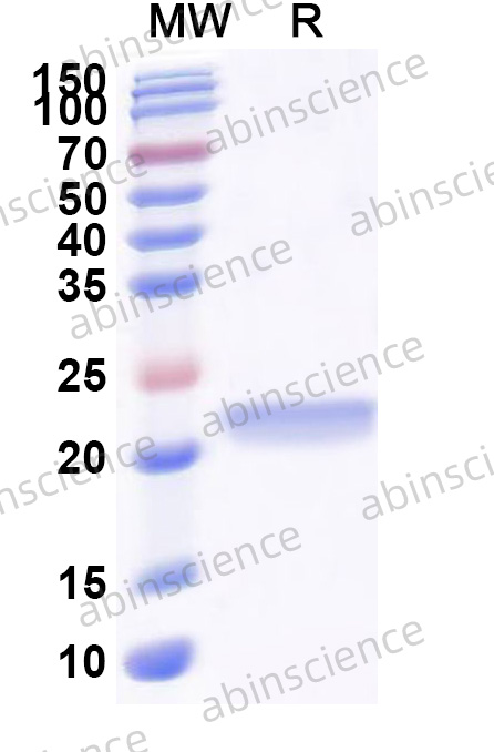 Recombinant HPV16 E6 Protein, C-His