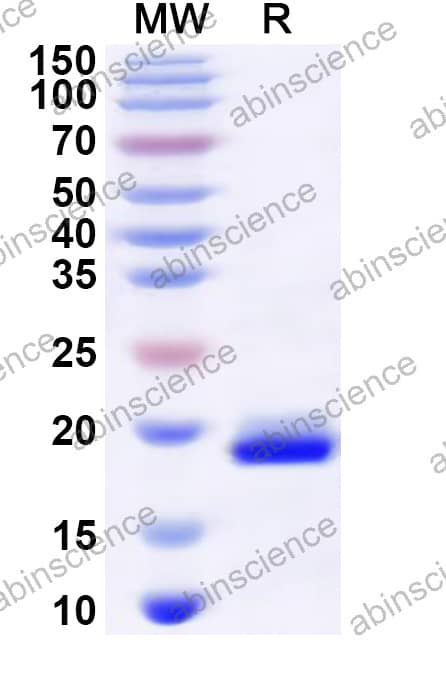 SIV Nef Recombinant Protein (N-His)