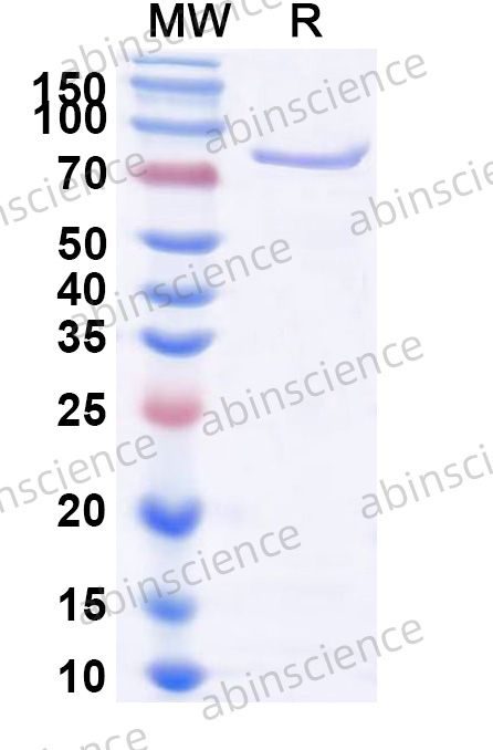 Recombinant HPV58 L1 Protein, N-GST & C-His
