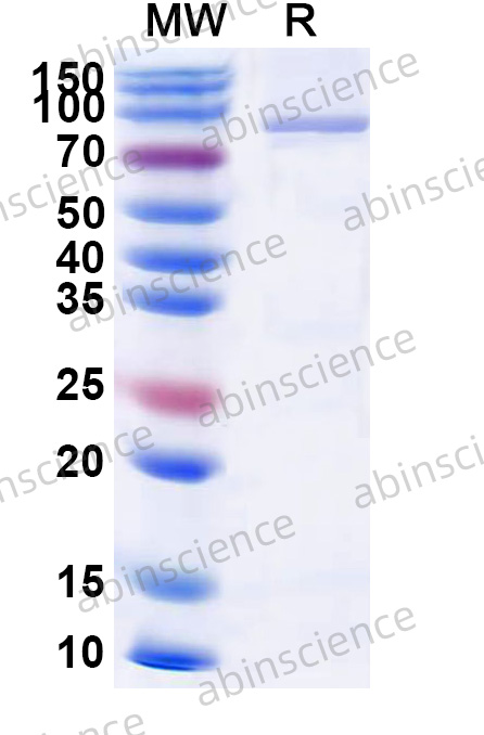 Recombinant HPV59 L1 Protein, N-GST & C-His