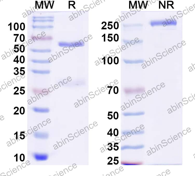 Anti-HPV16 L1/Major capsid protein L1 Antibody (SAA2553)
