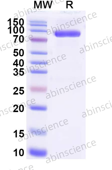McHV-1 gC Recombinant Protein (C-Fc)