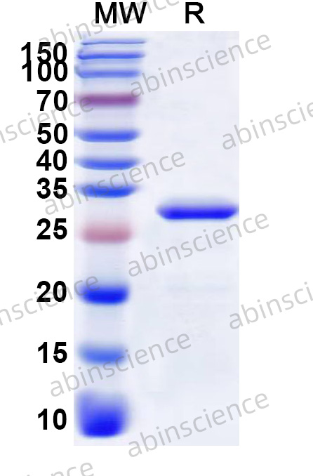 McHV-1 Protease Recombinant Protein (N-His)