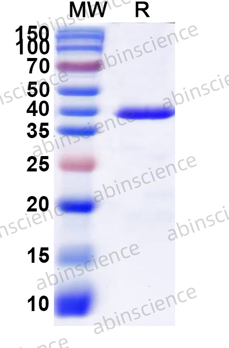 McHV-1 gD Recombinant Protein (N-His)