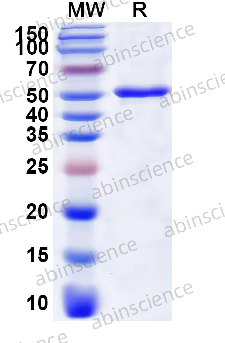 McHV-1 gH Recombinant Protein (N-His)