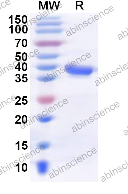 McHV-1 gH Recombinant Protein (N-His)