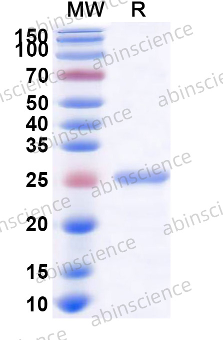 McHV-1 gL Recombinant Protein (N-His)