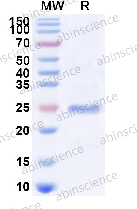 Recombinant EBV/HHV4 gp42 Protein, N-His