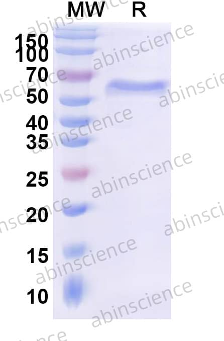 SIV Gag polyprotein Recombinant Protein (N-His)