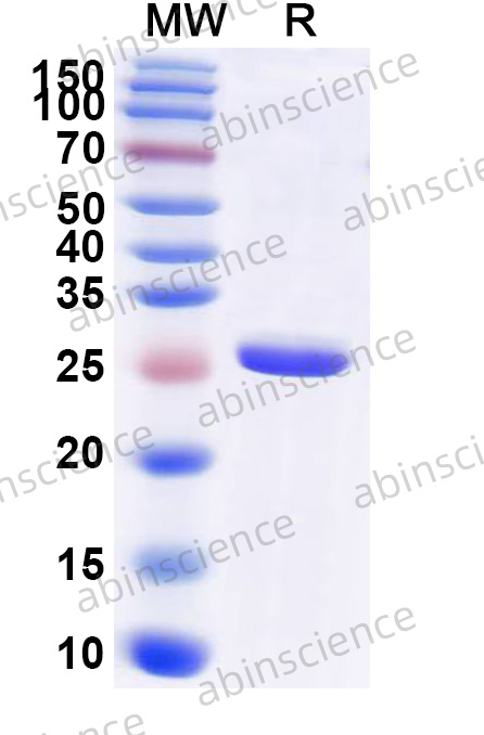 FMDV (SAT-1) VP1 Recombinant Protein (N-His)