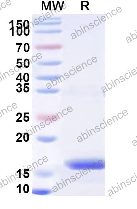 SPPV HM2 Recombinant Protein (N-His)