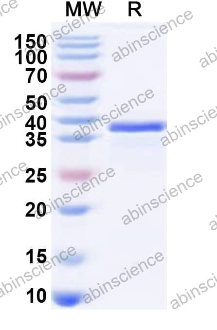 HSV1/HHV-1 glycoprotein B/gB Recombinant Protein (N-His)