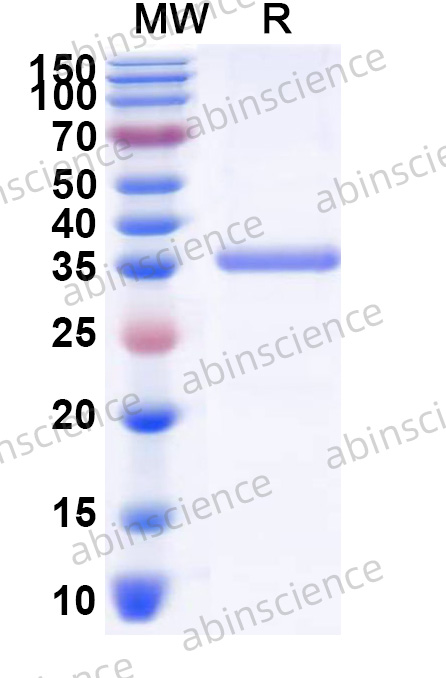 SVA VP1 Recombinant Protein (N-His)