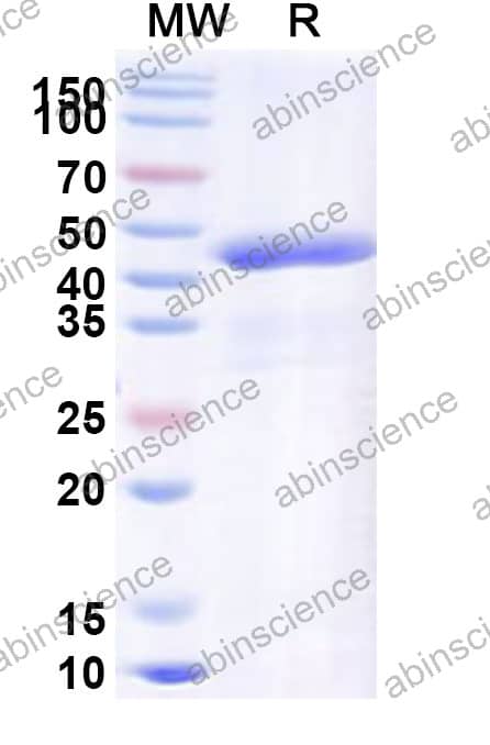 SVA VP2 Recombinant Protein (N-His)