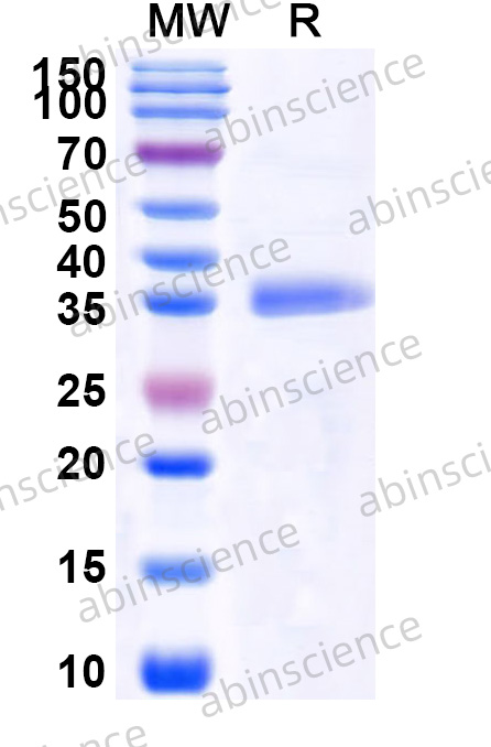 Anti-HPV16 E7/Protein E7 Polyclonal Antibody