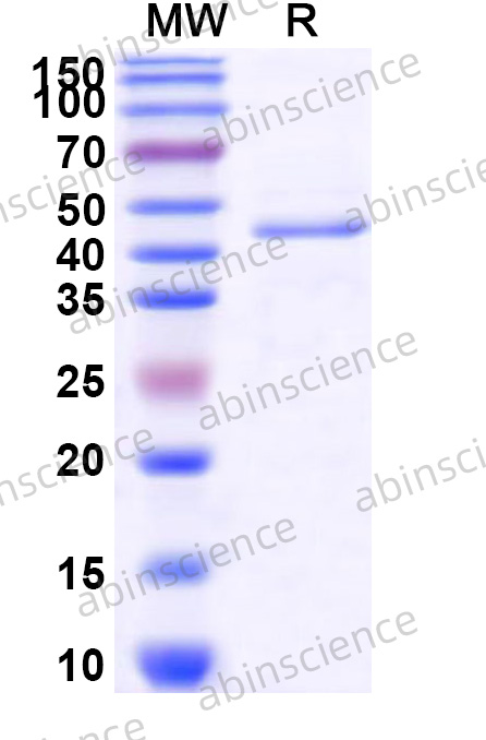 Recombinant HPV16 E7 Protein, N-GST&C-His
