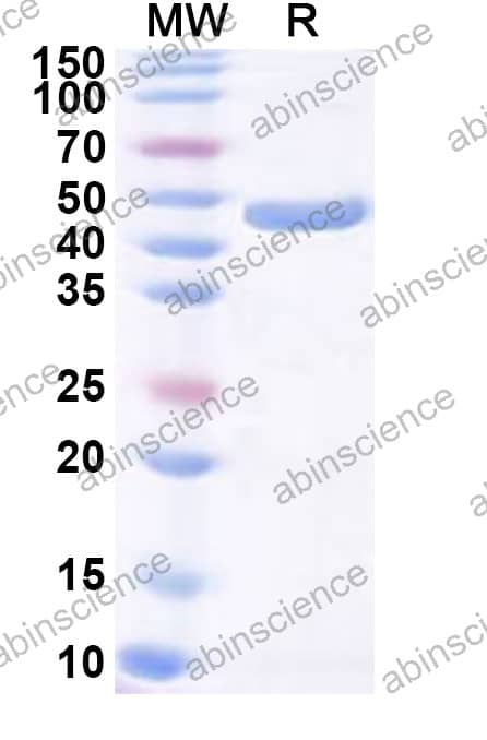 Recombinant HPV59 E7 Protein, N-GST & C-His