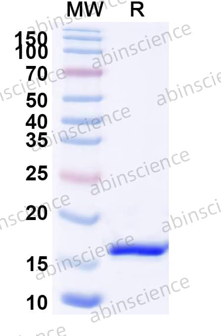 Recombinant HPV18 E7 Protein, N-His