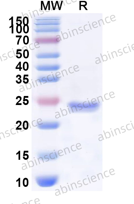 VZV/HHV-3 gE/ORF68 Recombinant Protein (N-His)