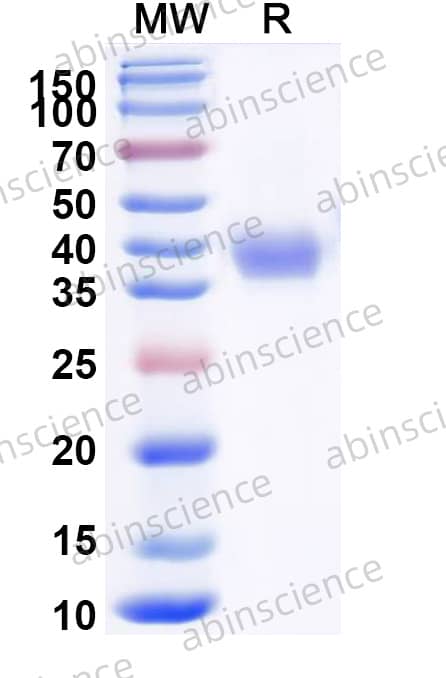 Recombinant SARS-CoV-2 RBD (NB.1.8.1) Protein, C-His