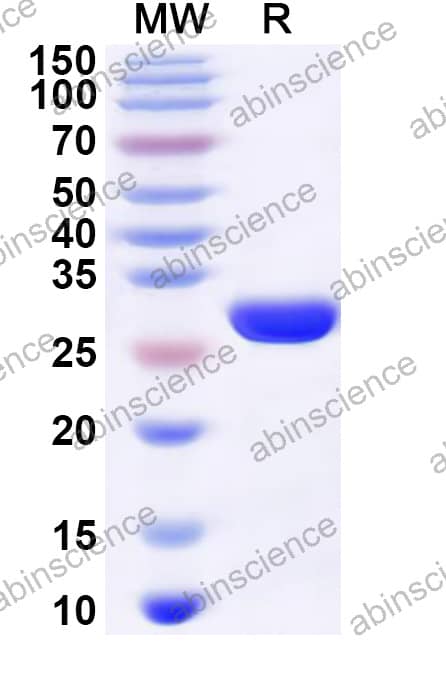 RD114 retrovirus Capsid p30 Recombinant Protein (N-His)
