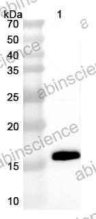 Anti-DENV-3 Envelope protein E Polyclonal Antibody