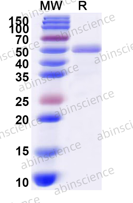 DENV-3 Envelope protein E Recombinant Protein (N-His)