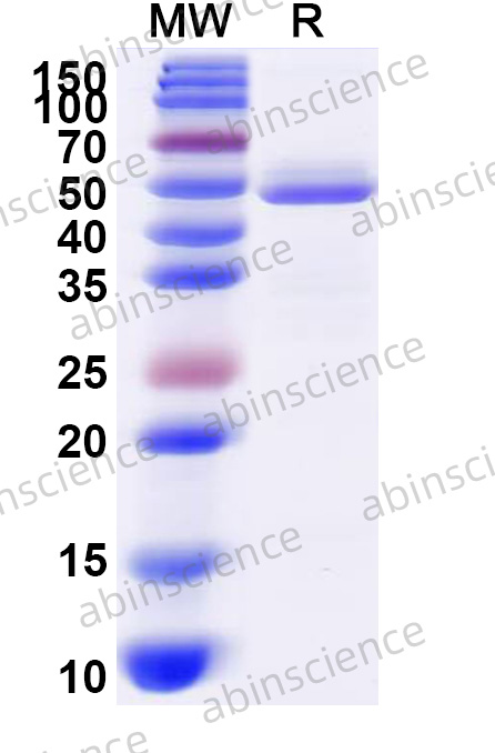 DENV-4 Envelope protein E Recombinant Protein (N-His)