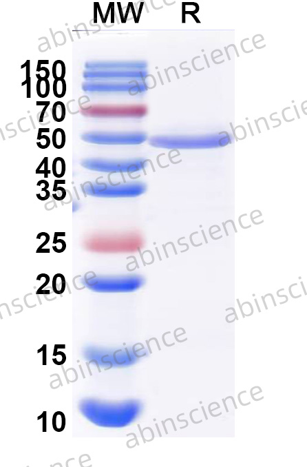 DENV-1 Envelope protein E Recombinant Protein (N-His)