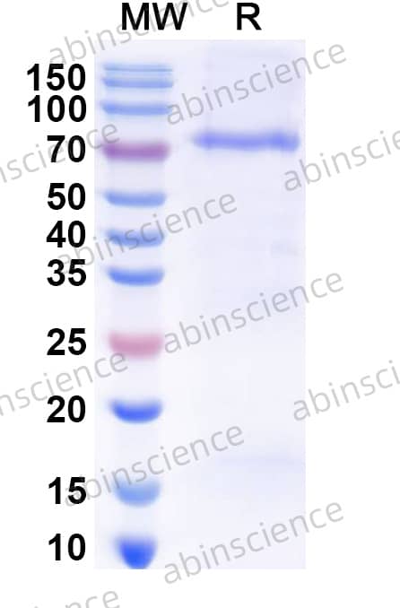 Recombinant EBV/HHV4 gH/Envelope glycoprotein H Protein, N-His