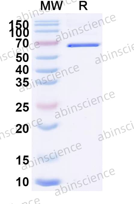 SeV HN Recombinant Protein (C-His)