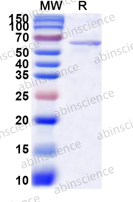 Recombinant CCHFV Gc Protein, N-His