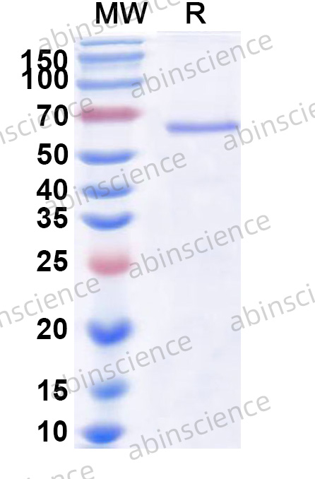 SIV gp120 Recombinant Protein (N-His)