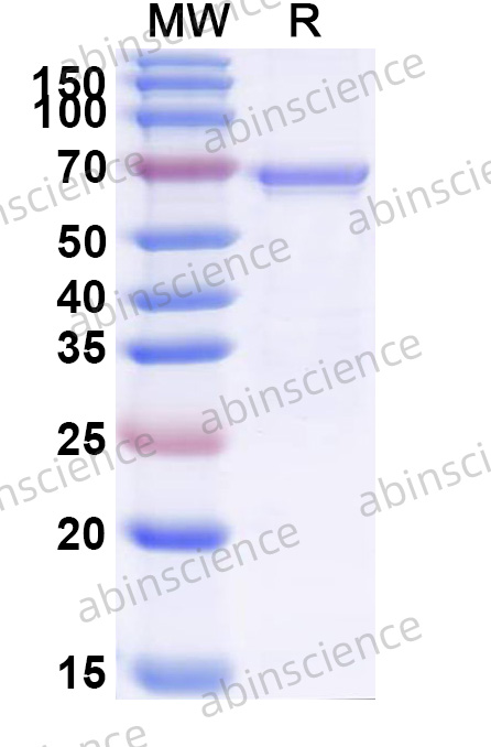 CHIKV NSP4 Recombinant Protein (N-His)