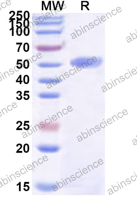 HHV-5/HCMV UL83 Recombinant Protein (N-GST)