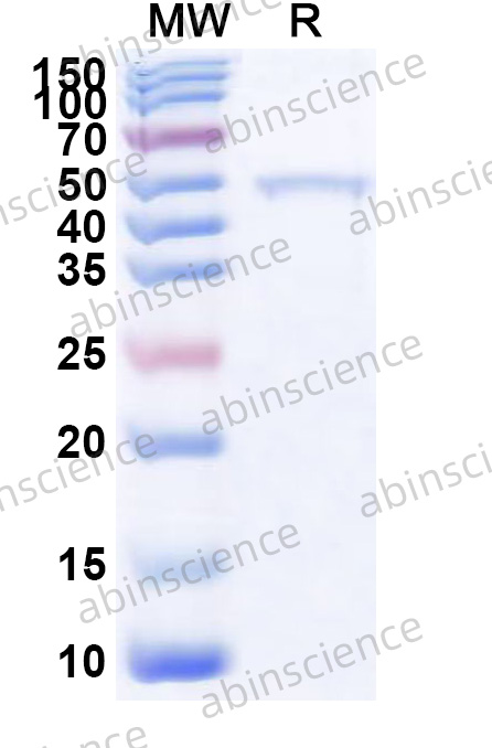 Recombinant Orthohantavirus puumalaense Glycoprotein C/Gc, N-His